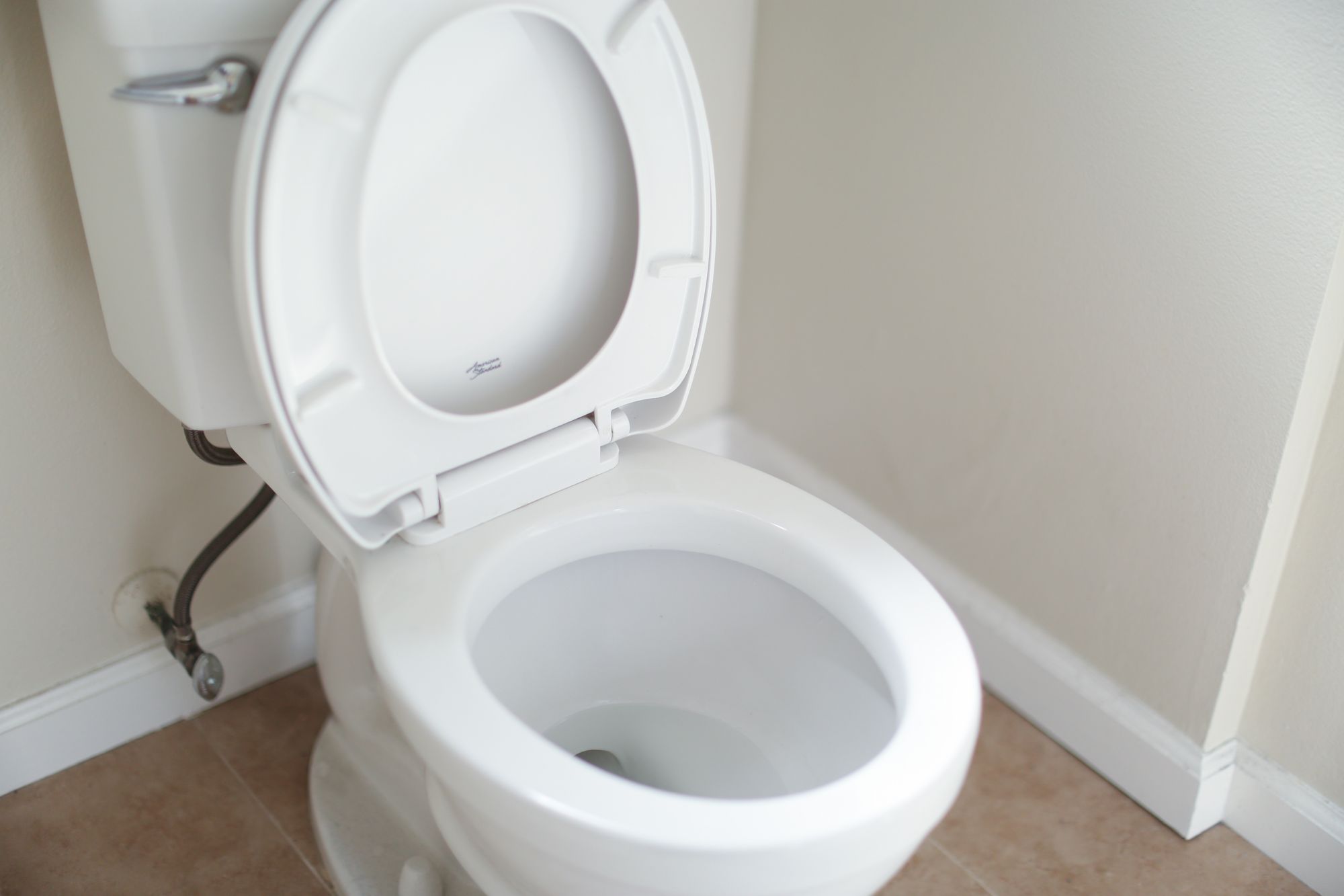 Understanding the Parts of a Toilet